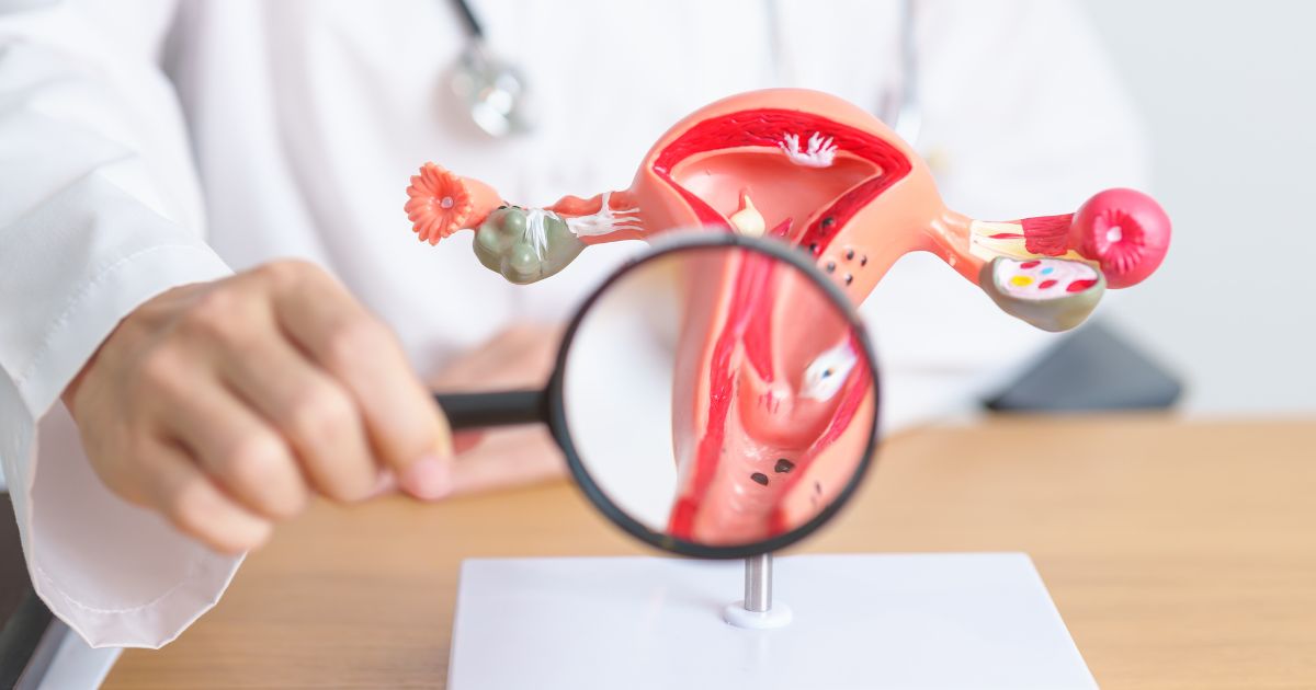 Endométriose : Une maladie complexe, des solutions efficaces